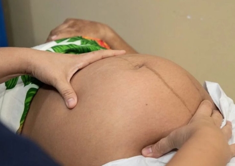 MPF cobra que violência obstétrica vire infração ética no Amazonas