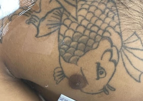 Vítima de agressão física aguarda identificação no HPS João Lúcio