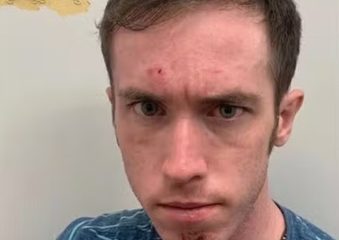 Homem é preso por fingir deficiência para que babás o trocassem