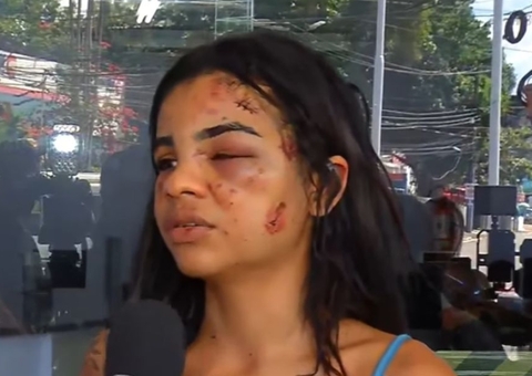 Jovem de 20 anos é espancada após recusar homem em Manaus