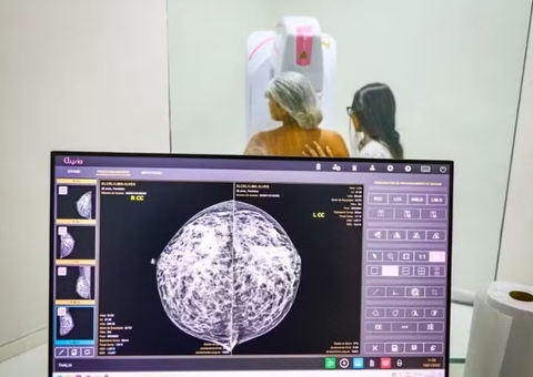 Ministério da Saúde passa a recomendar mamografia a partir dos 40 anos