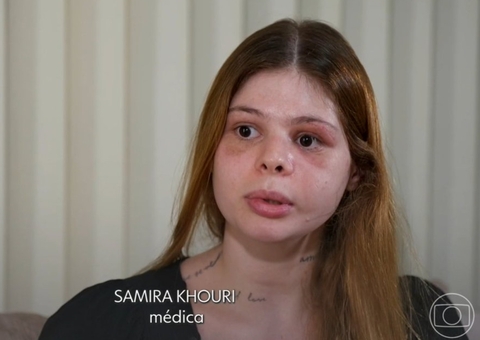 "Senti a vida indo embora", diz médica agredida por ex que a deixou desfigurada