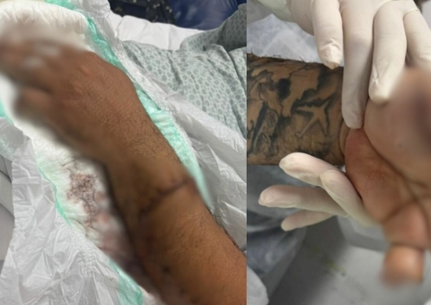 Passageiro ataca motorista de app com terçado e pitbull em Manaus