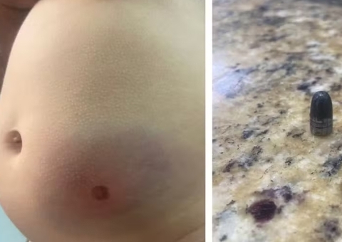 Bebê de 11 meses é atingida por bala perdida dentro de casa