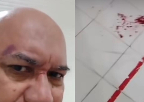 Filhos se revoltam e agridem equipe médica após morte da mãe no Amazonas; vídeo