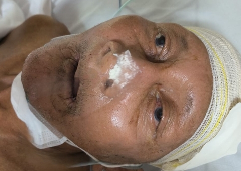 Sem identificação, idoso internado aguarda reencontro com a família em Manaus