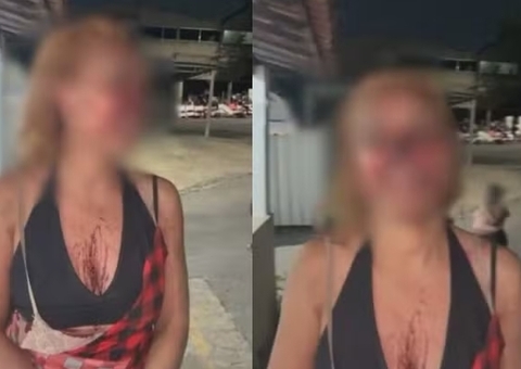 Advogada é espancada com pá de ferro e vassoura por discussão sobre lixo