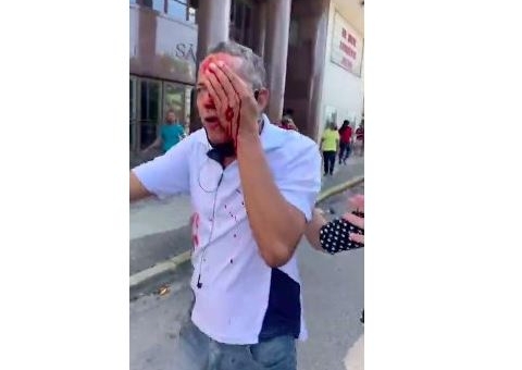 Homem fica cego ao ser atingido por bala de borracha da PM em ato contra Bolsonaro