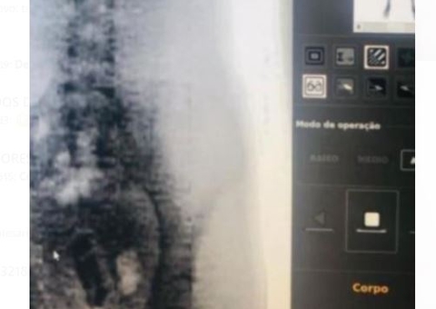 Mulher é flagrada em visita no Compaj com celular nas partes íntimas