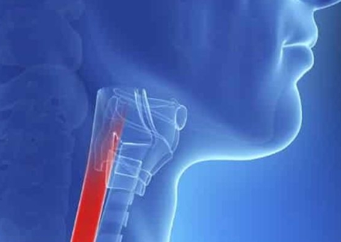 Estudo investiga como começa e evolui o câncer de esôfago