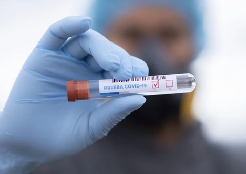 Amazonas registra 62 novos casos de Covid em 24 horas