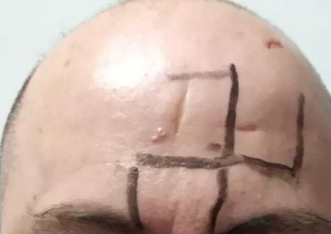 Homem gay é dopado e tem ameaças gravadas pelo corpo