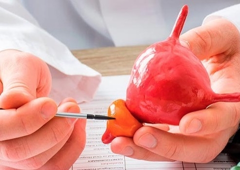 Alerta: 25% dos homens entre 40 a 49 anos podem ter o aumento benigno da próstata