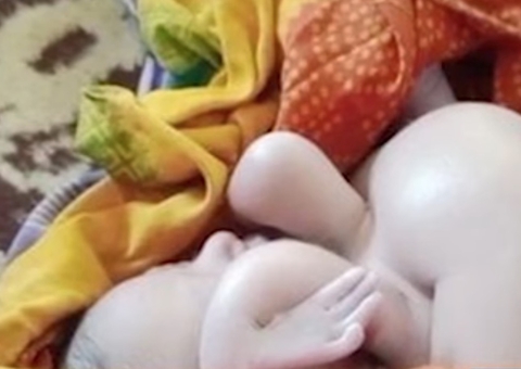 Bebê nasce com quatro pernas e quatro braços e é idolatrado na Índia