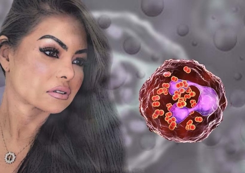 Meningite: como se pega a doença que atingiu cérebro de Paulinha Abelha?