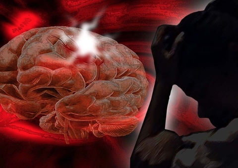 Estudos apontam aumento da incidência de AVC em mulheres jovens