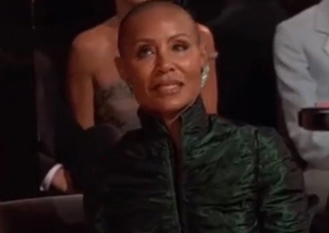 Entenda o que é alopécia, condição da esposa de Will Smith