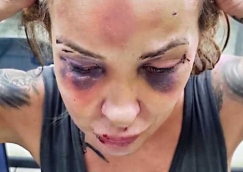 Jornalista é espancada por namorado com soco-inglês e cassetete por três dias