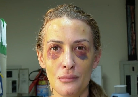 Namorado que agrediu jornalista com soco inglês por 3 dias já torturou ex e agrediu avós