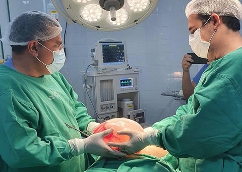 Idosa passa 1 mês com dor abdominal e médicos descobrem cisto de 5 kg; veja