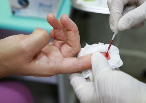 Hepatites virais: conheça os sintomas; como se prevenir e onde realizar testagem em Manaus