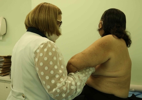 Mulheres mastectomizadas têm atendimento psicológico garantido no Amazonas