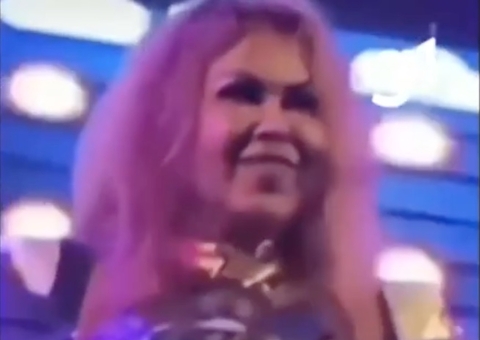 Sequelas da Covid podem causar inchaço? Entenda o caso de Joelma