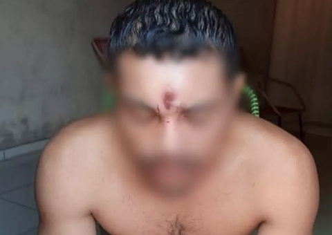 Homem leva tiro na testa e vai para casa dormir; Entenda como é possível