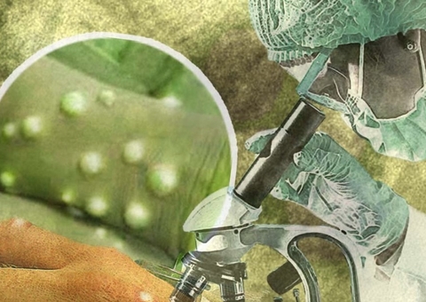 Primeiro caso de varíola dos macacos é confirmado no Brasil