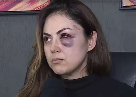 Homem que espancou procuradora é suspenso e tem salário cortado