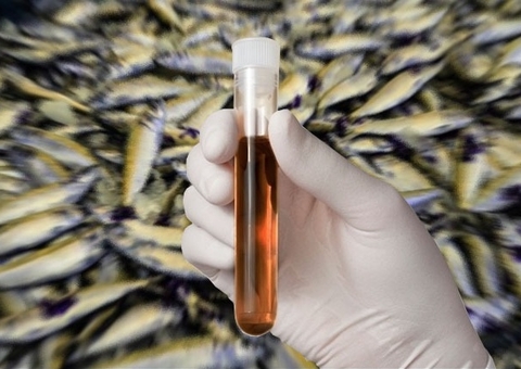 Autoridades investigam uma morte e outros 3 casos de urina preta no Pará