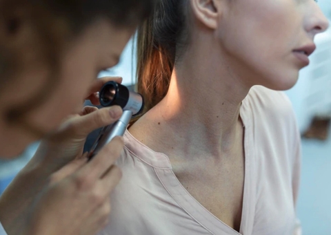 Sinais no corpo? Saiba como identificar o câncer de pele