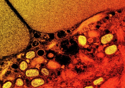 Sem medicação, varíola dos macacos pode causar cegueira