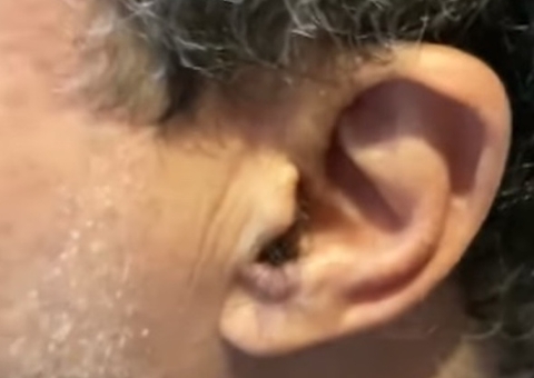 Saiba porque homens na faixa dos 50 anos começam a ter mais pelos na orelha e no nariz