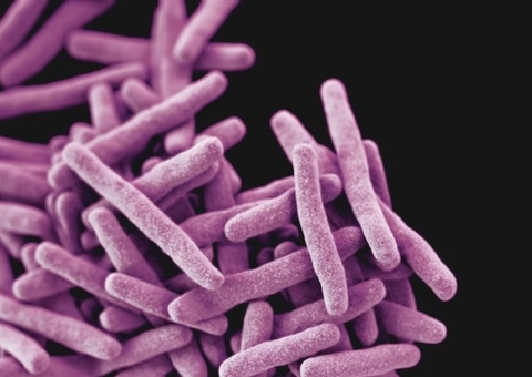 Tosse com mais de 2 semanas pode ser tuberculose; conheça os sintomas