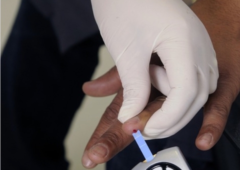 Colesterol alto? Saiba como reduzir riscos e reconhecer sintomas