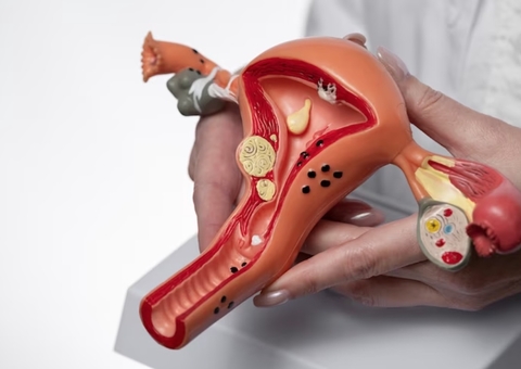 Silencioso e de difícil diagnóstico: câncer de ovário é um dos tumores mais letais