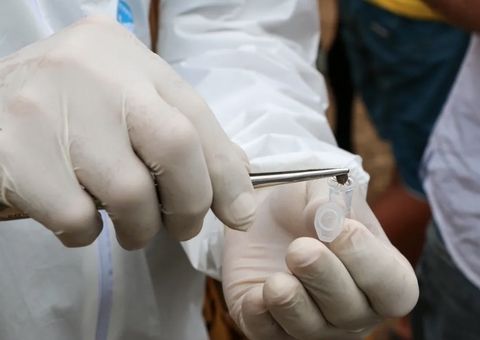 Especialista ensina como retirar carrapato da pele com segurança