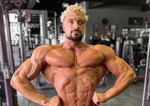 Fisiculturista morto por aneurisma aos 30: conheça os riscos dos anabolizantes
