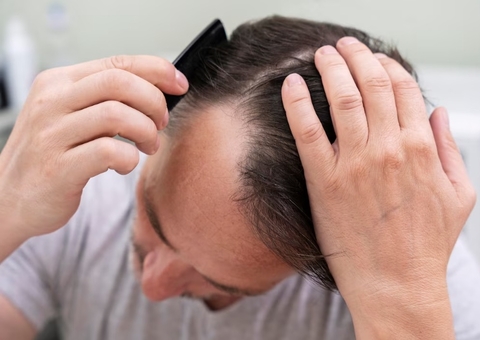 Porque estamos perdendo cabelo? Especialista explica quando devemos nos preocupar