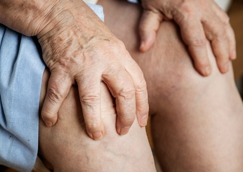 Dores e inchaços nas pernas podem ser sinais de alerta de trombose