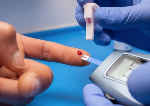 Nutricionista ensina como evitar o colesterol alto com alimentação saudável