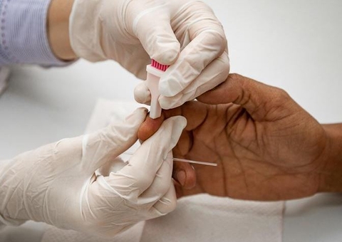 Europa informa novos casos de hepatite de causa desconhecida