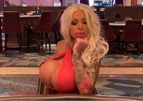 Atriz pornô mostra foto de como ficou seio após prótese de silicone explodir