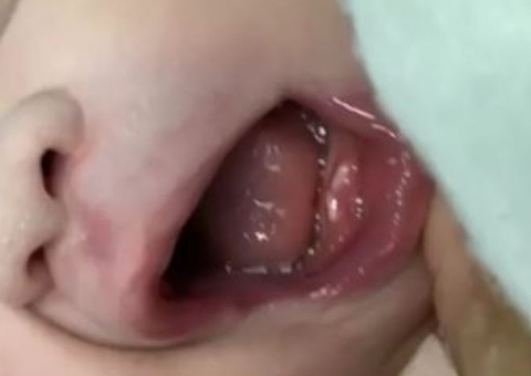 Mãe se assusta ao saber que bebê nasceu com dois dentes