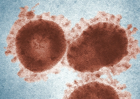 Rio de Janeiro investiga caso suspeito de varíola dos macacos