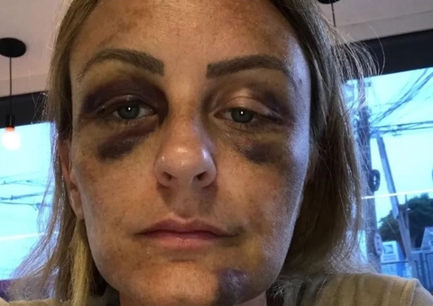 Ex de brasileiro que agrediu surfista americana revela que também foi espancada por ele