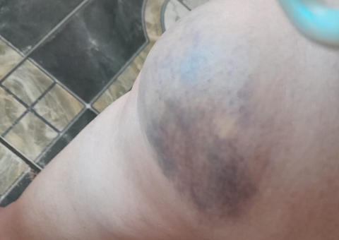 Mulher denuncia ex-sogro por agredi-la grávida e relata ameaças em Manaus 