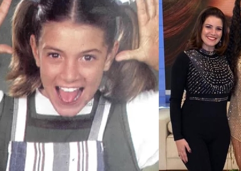 Após botox, ex-Chiquitita perde movimento do olho temporariamente 