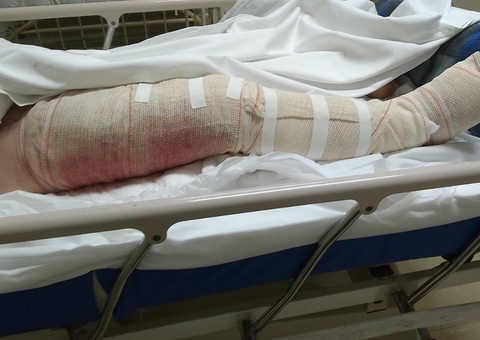 Criança é picada por cobra enquanto brincava em barco